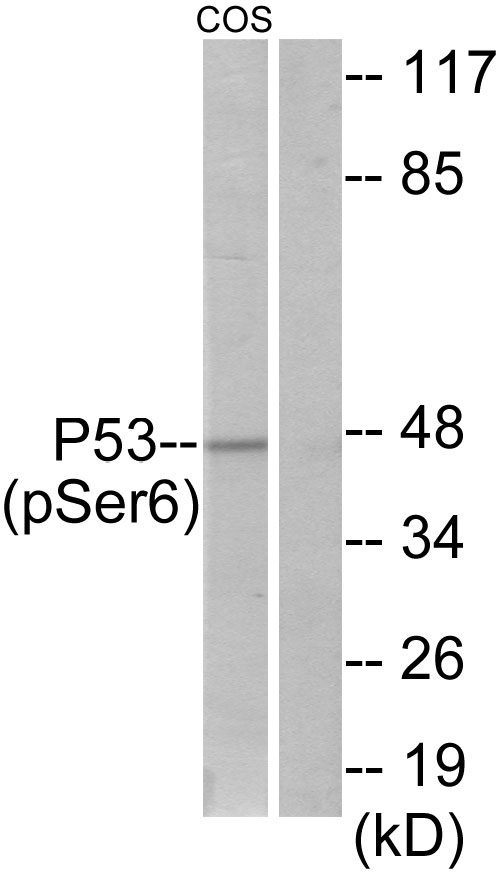 P-p53 (s6) Ab - 上海埃必威生物技术有限公司