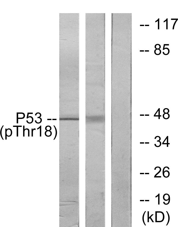 p-p53 (T18) Ab