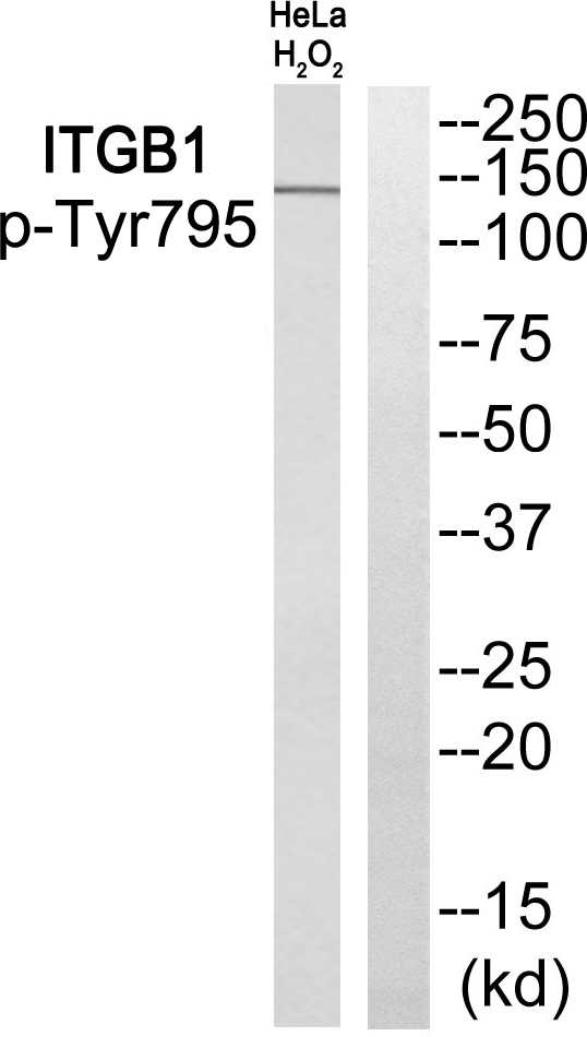 p-Integrin beta 1 (Y795) Ab