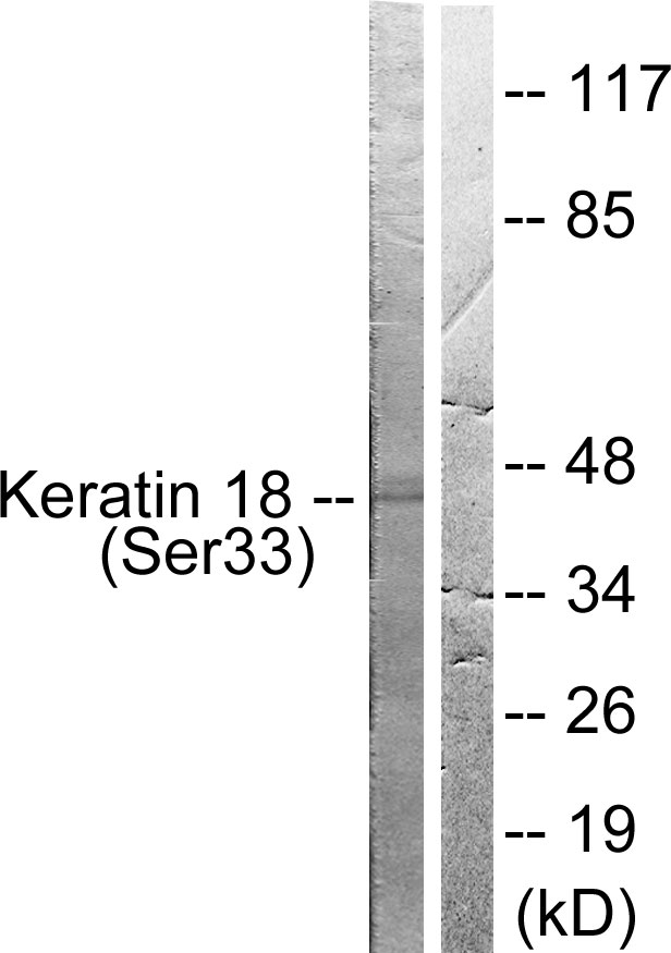 p-Cytokeratin 18 (S33) Ab