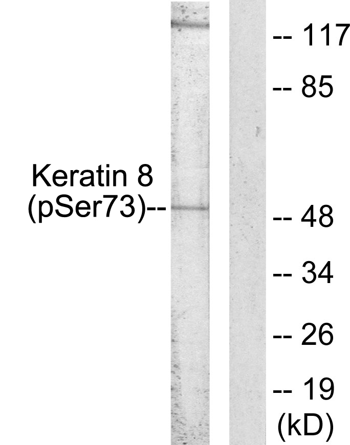 p-Cytokeratin 8 (S74) Ab