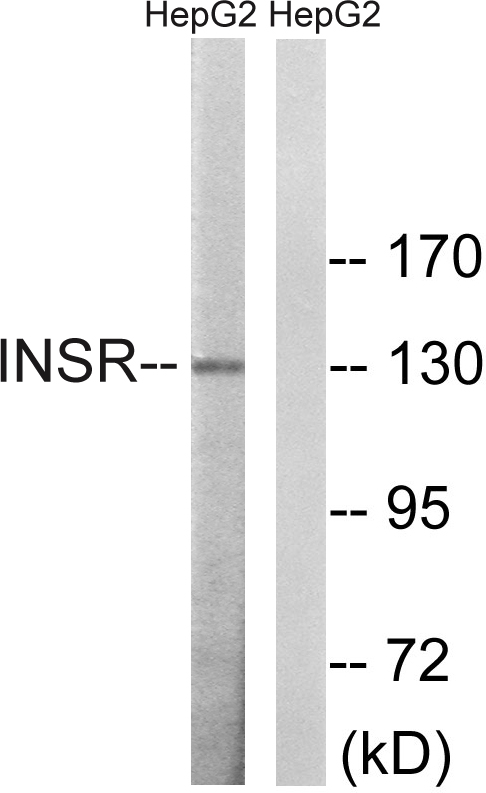 Insulin receptor Ab