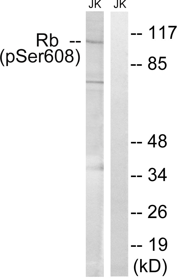 p-Rb (S608) Ab