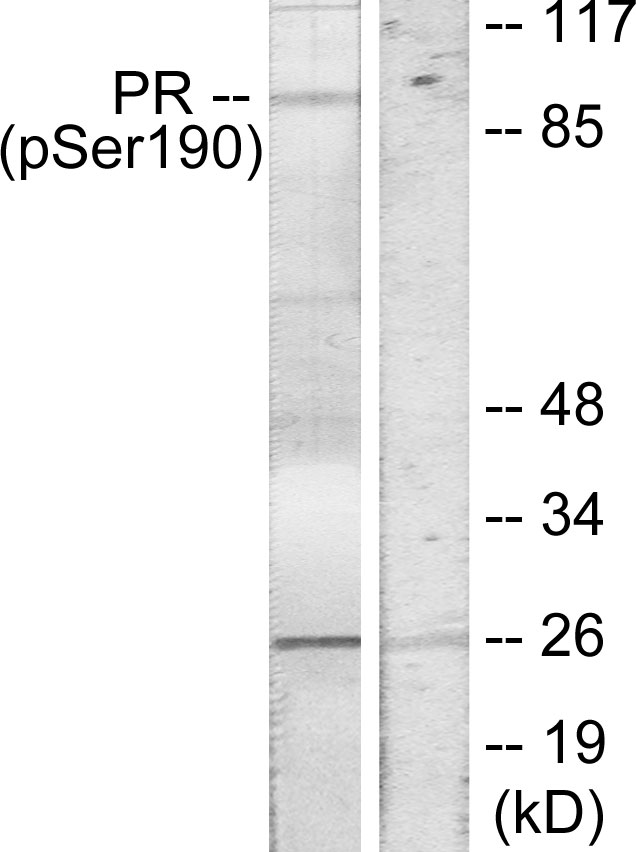 p-Progesterone receptor (S190) Ab