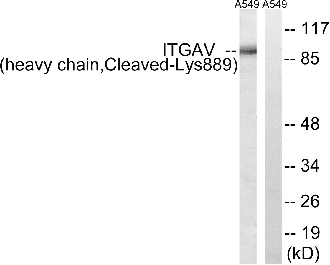 Integrin alpha 5 heavy chain Ab