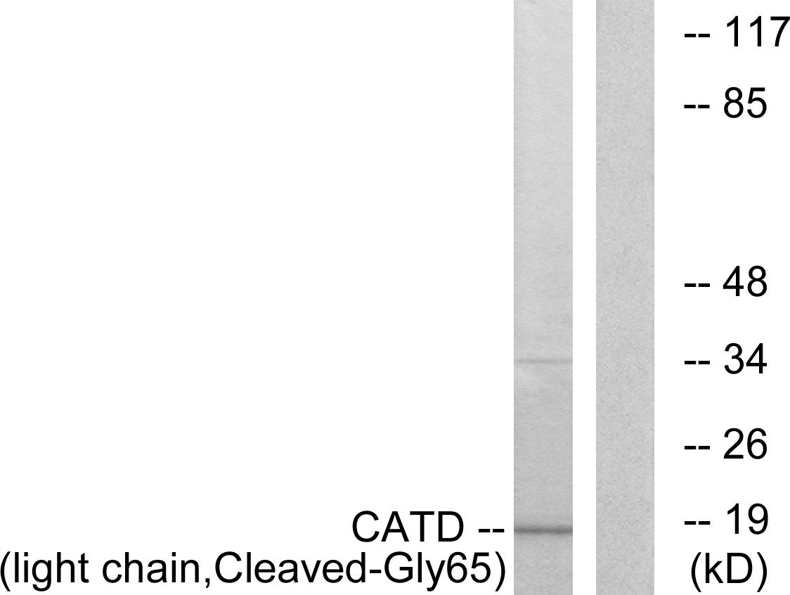 Cathepsin D light chain Ab