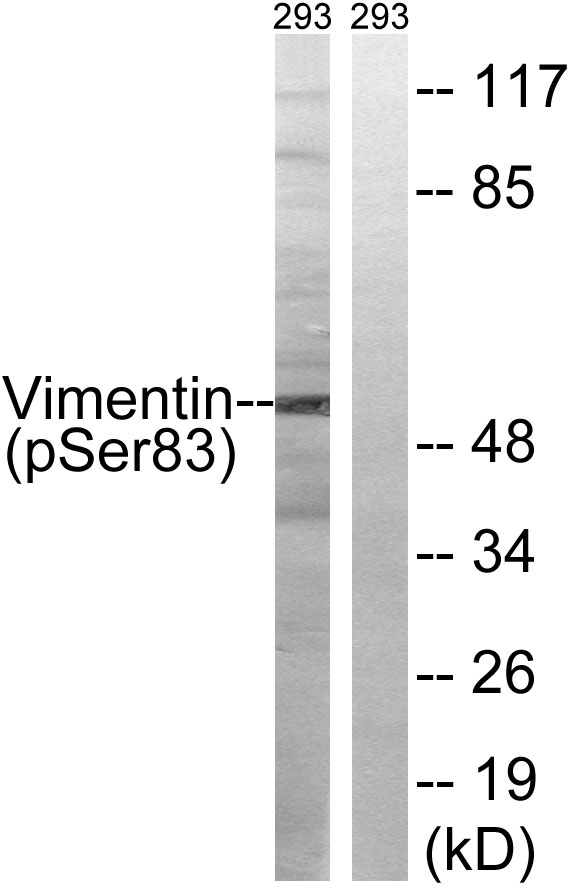 p-Vimentin (S83) Ab