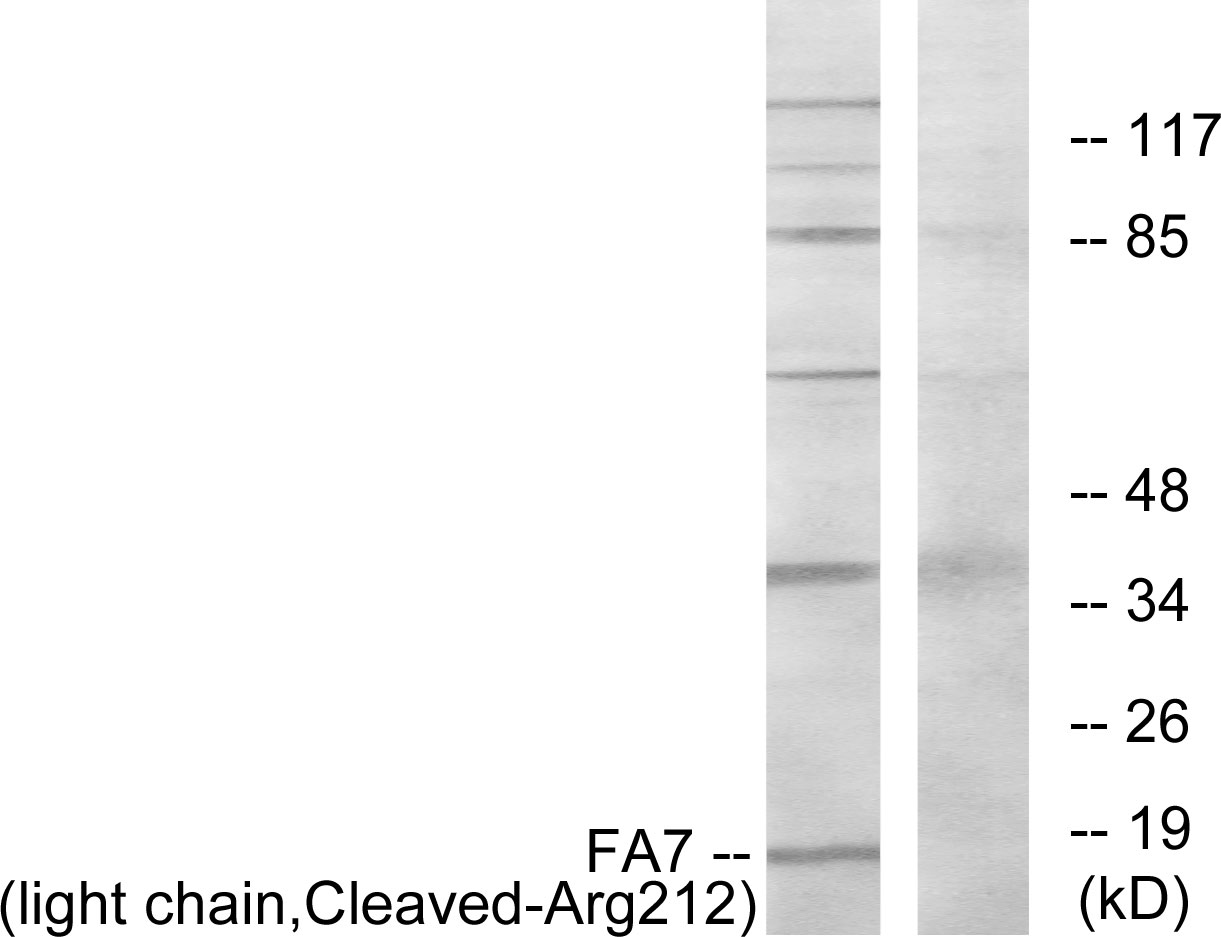 Coagulation factor VII light chain Ab