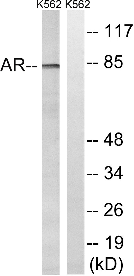 Androgen receptor Ab