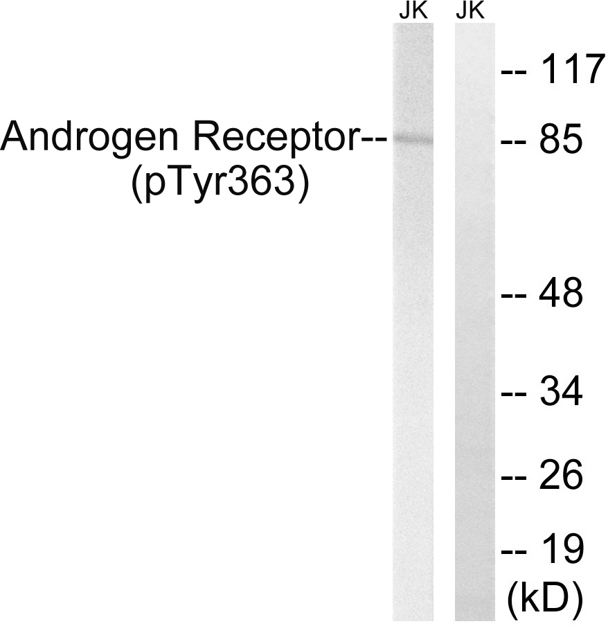 p-Androgen receptor (Y363) Ab