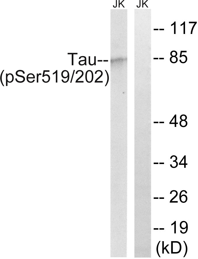 p-Tau (S519/202) Ab