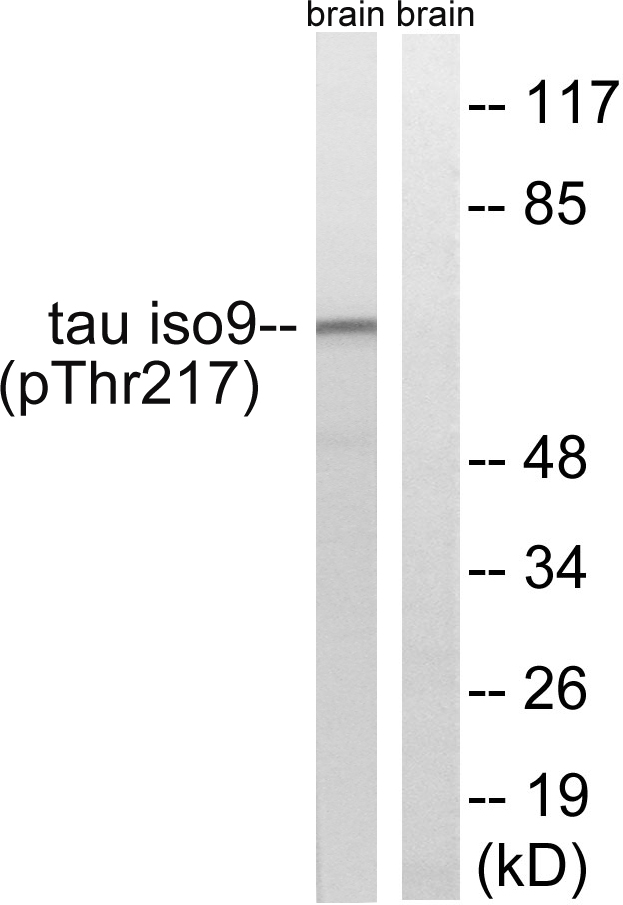 p-Tau (T534/217) Ab