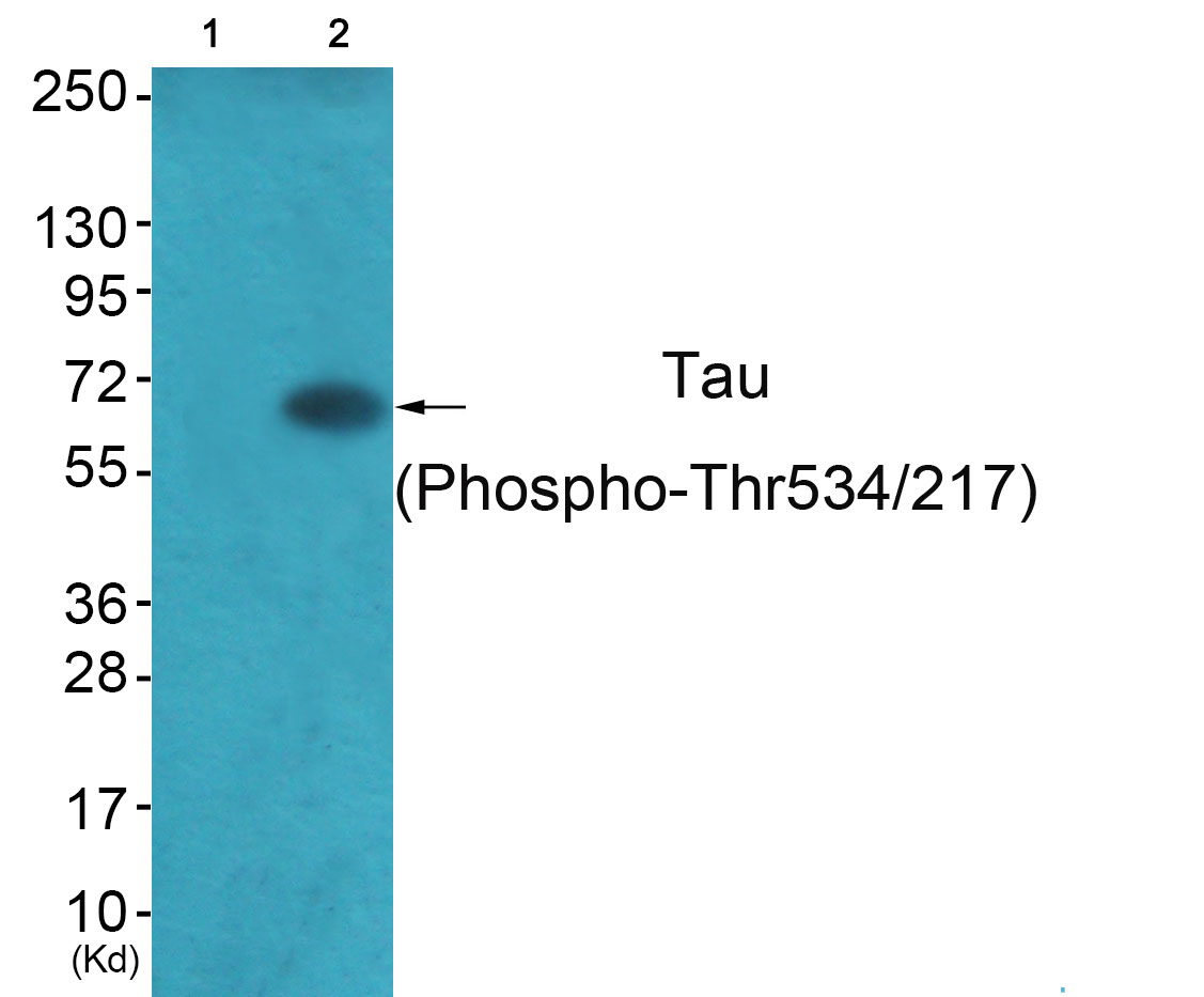 p-Tau (T534/217) Ab