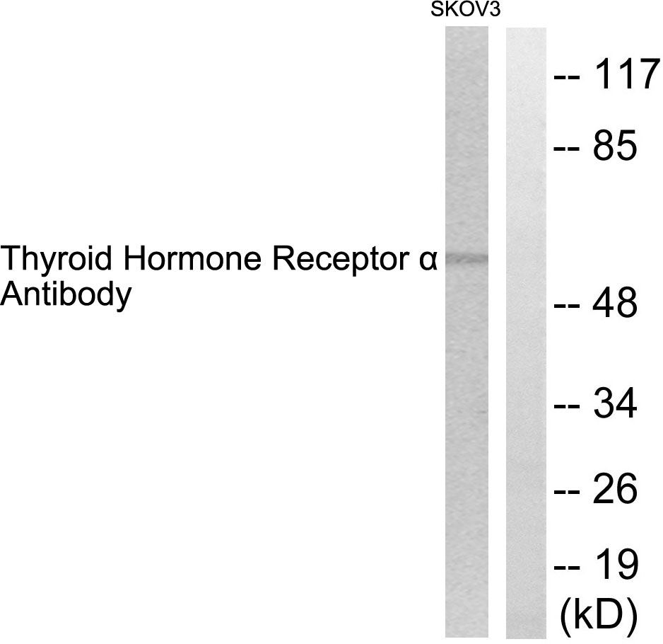 Thyroid hormone receptor alpha Ab