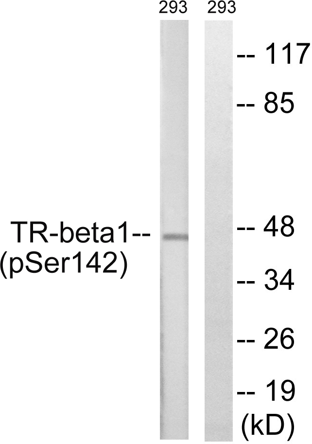 p-Thyroid hormone receptor beta (S142) Ab