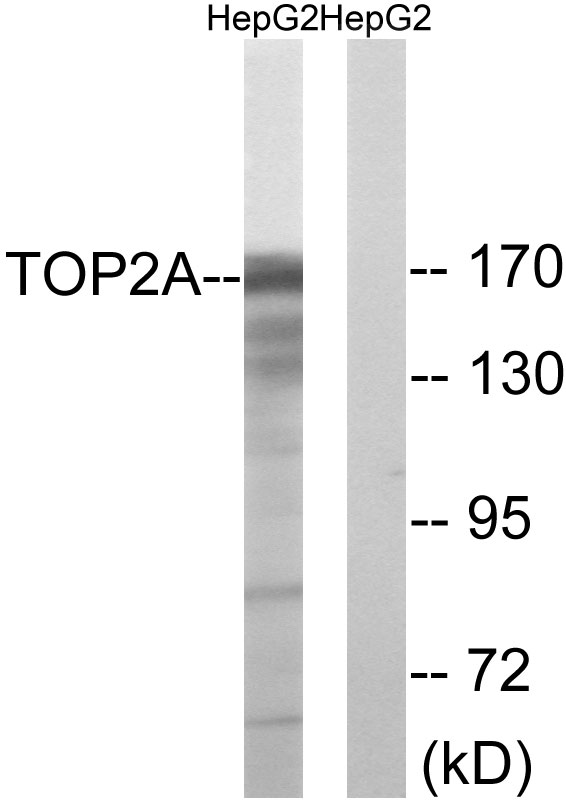 Topoisomerase 2 alpha Ab