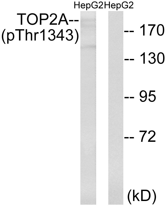 p-Topoisomerase 2 alpha (T1343) Ab