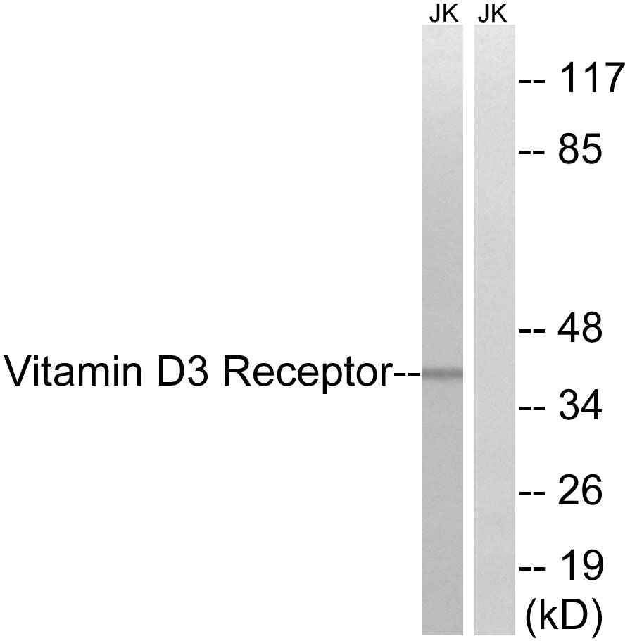 Vitamin D3 receptor Ab