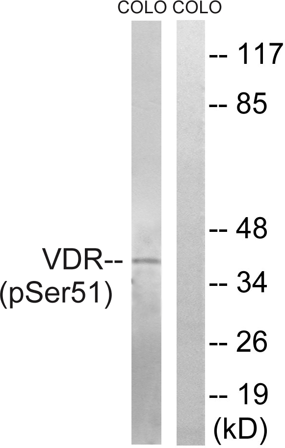 p-Vitamin D3 receptor (S51) Ab