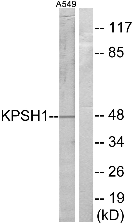 Serine kinase H1 Ab