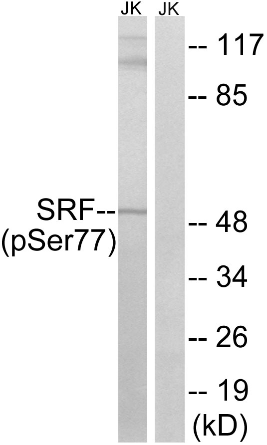 p-SRF (S77) Ab