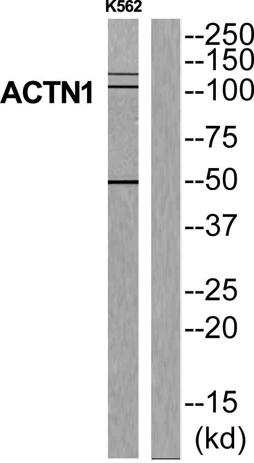 alpha Actinin 1 Ab