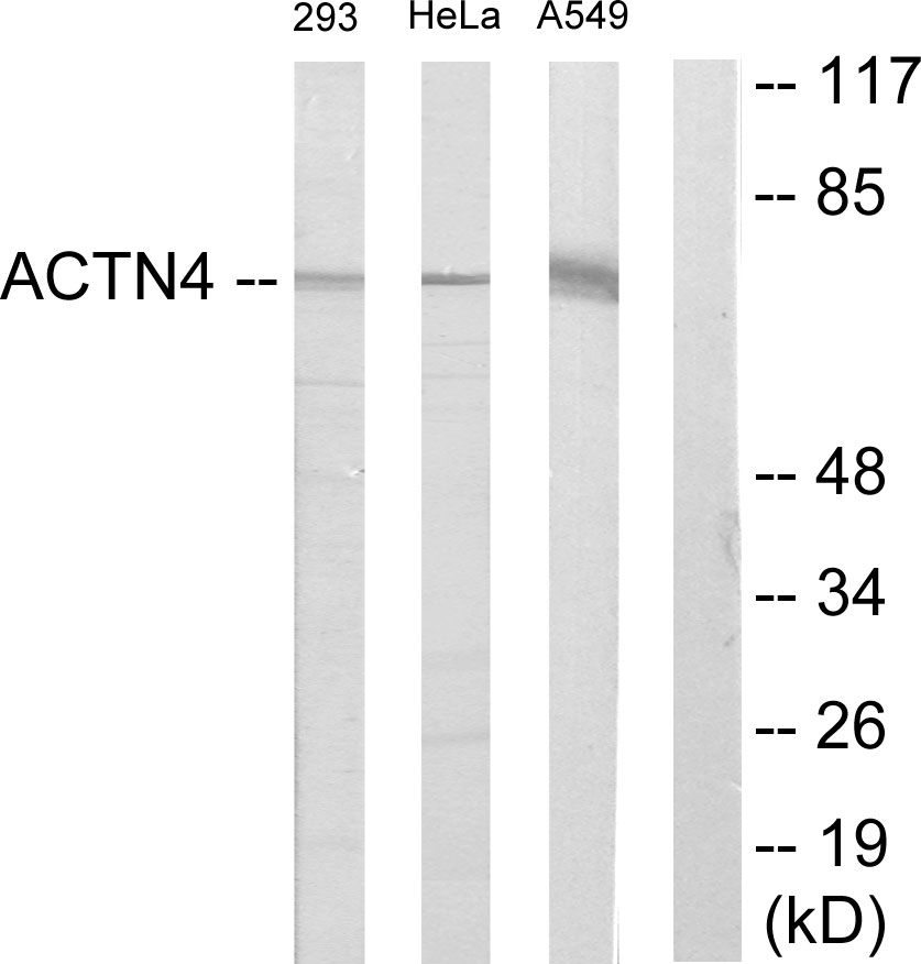 alpha Actinin Ab