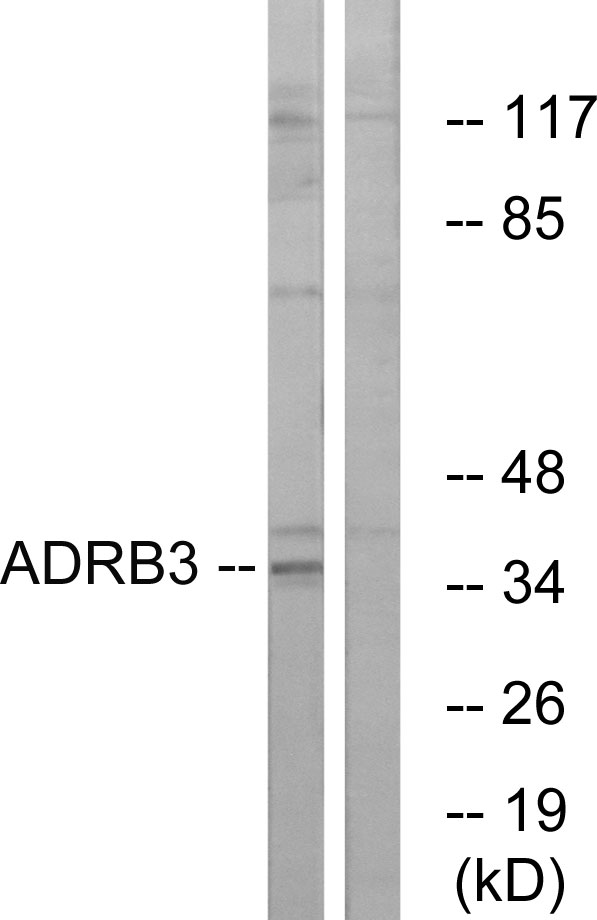 ADRB3 Ab