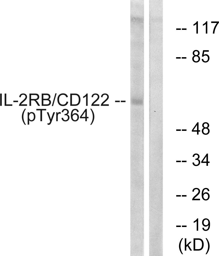 p-IL 2 receptor beta (Y364) Ab