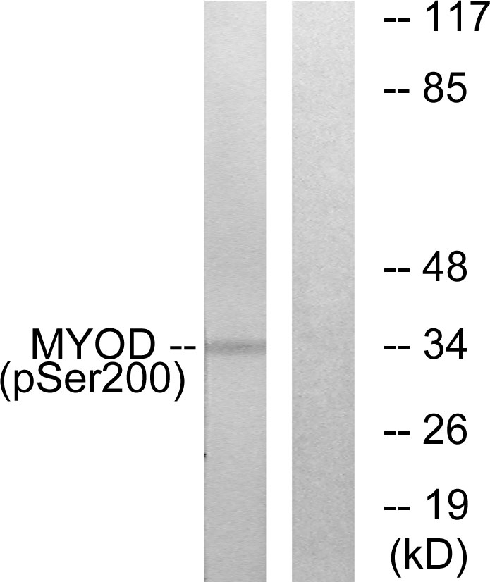 p-MYOD1 (S200) Ab