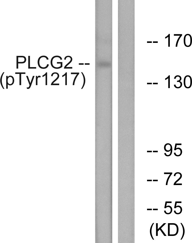 p-PLCG2 (Y1217) Ab