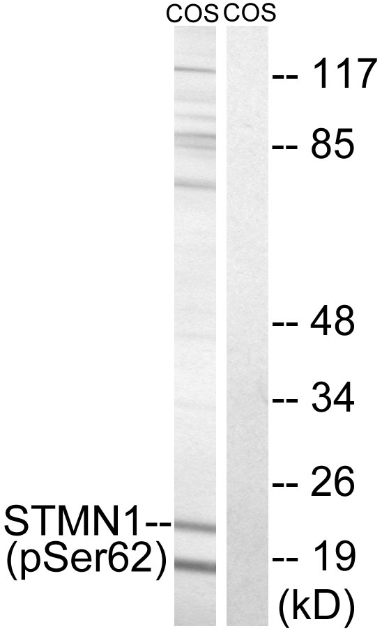 p-Stathmin 1 (S62) Ab