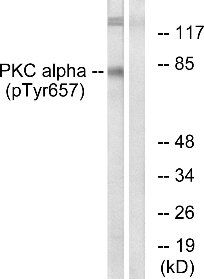 p-PKC alpha (Y657) Ab