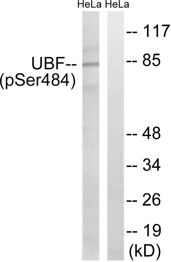 p-UBTF (S484) Ab