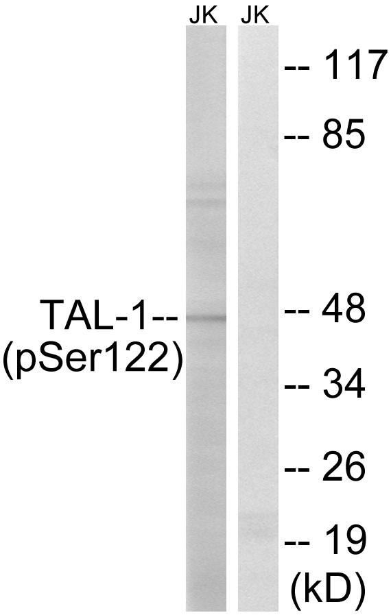 p-TAL1 (S122) Ab