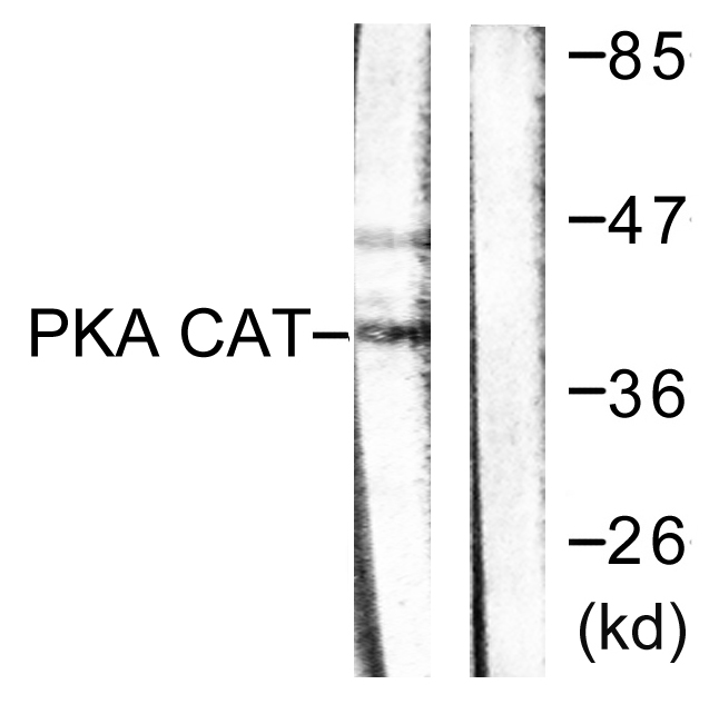 PKC alpha/beta/gamma Ab