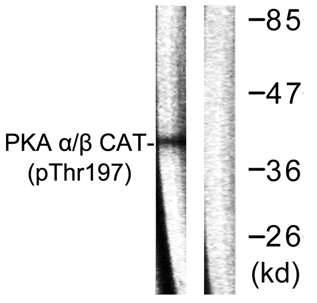 p-PKC alpha/beta/gamma (T197) Ab