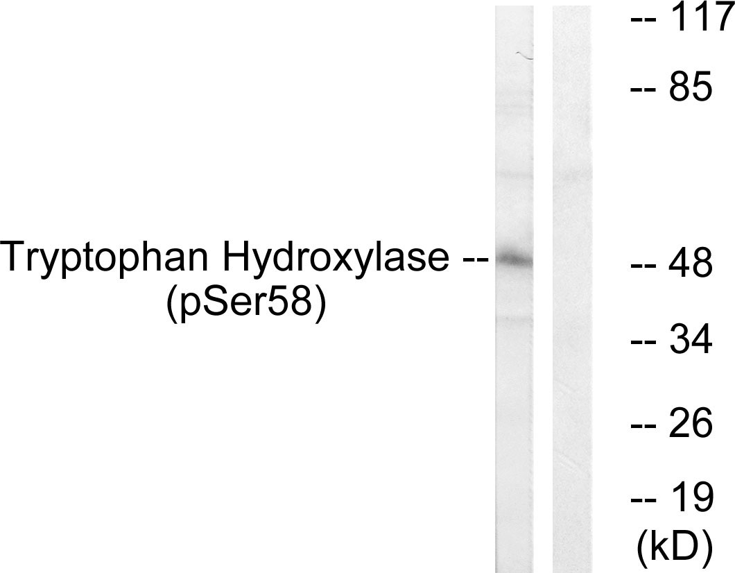 p-TPH1 (S58) Ab