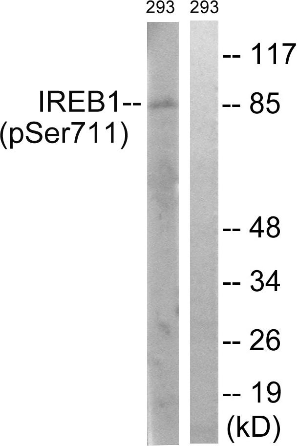 p-Aconitase 1 (S711) Ab