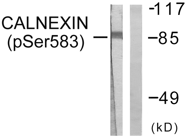 p-Calnexin (T456) Ab