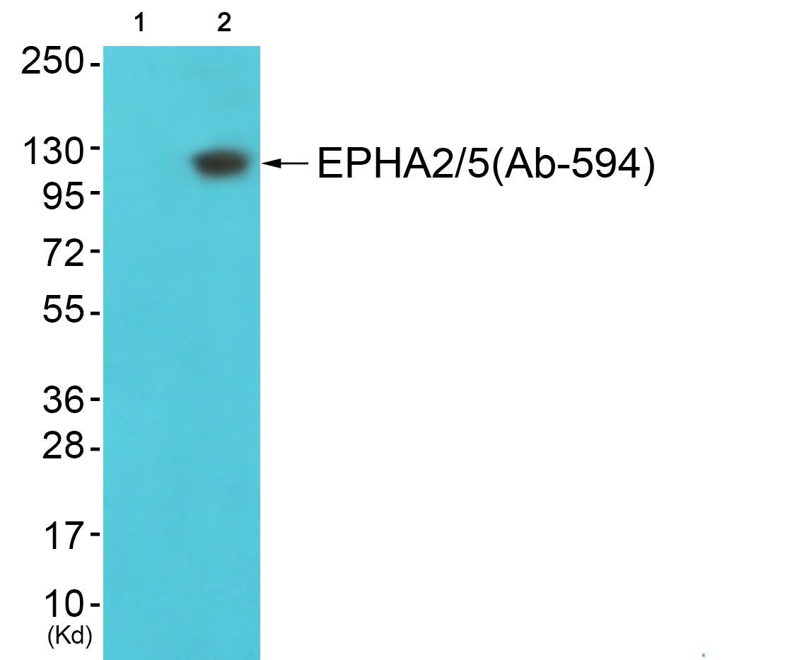EPHA2/5 Ab