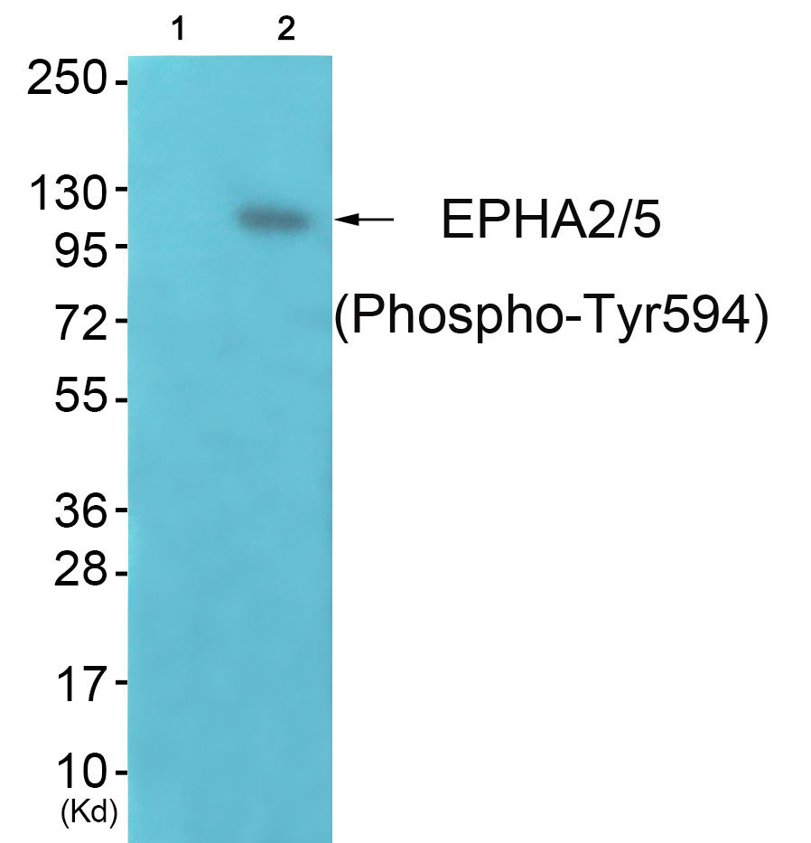 p-EPHA2/5 (Y594/Y656) Ab