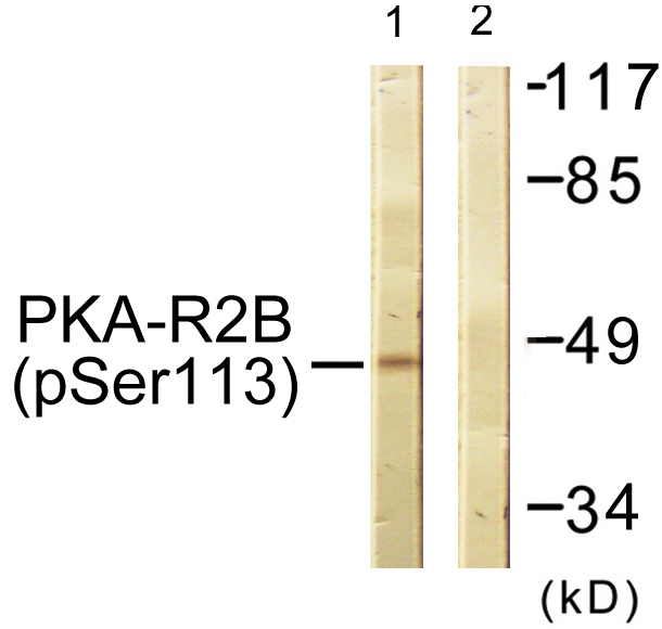 p-PRKAR2B (S113) Ab