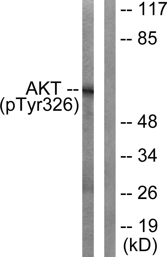 p-AKT1 (Y326) Ab