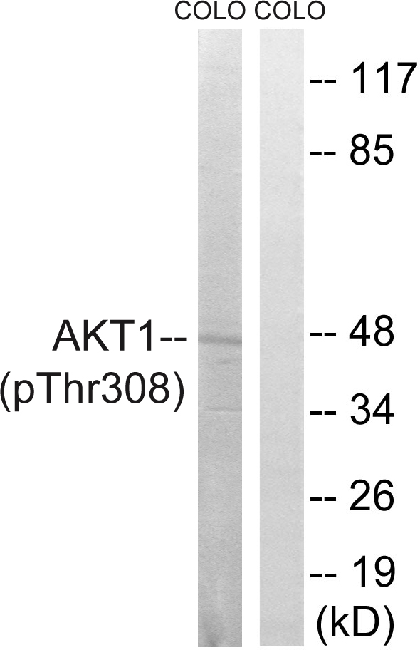 p-AKT (T308) Ab