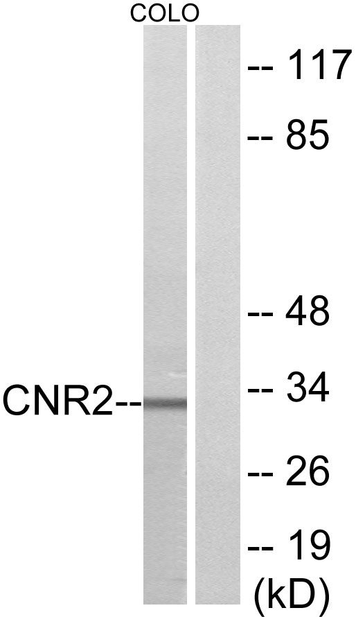 Cannabinoid receptor 2 Ab