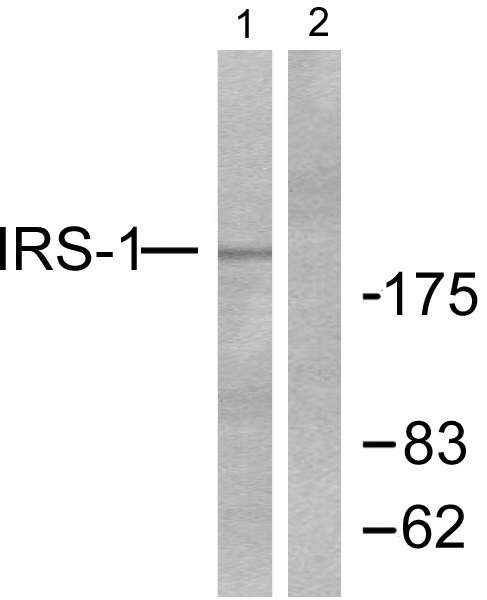 IRS 1 Ab