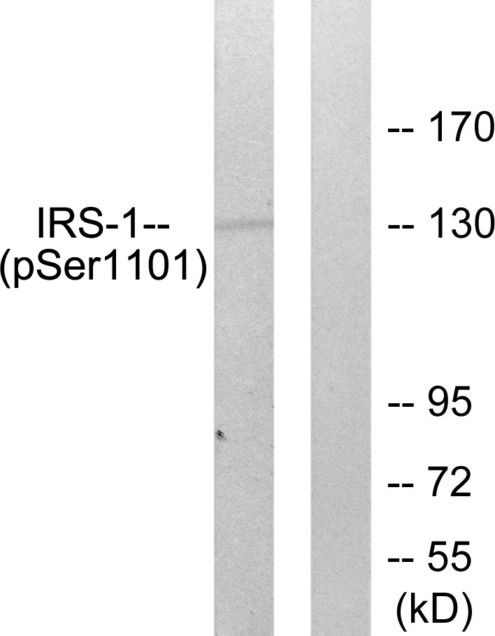 p-IRS 1 (S1101) Ab