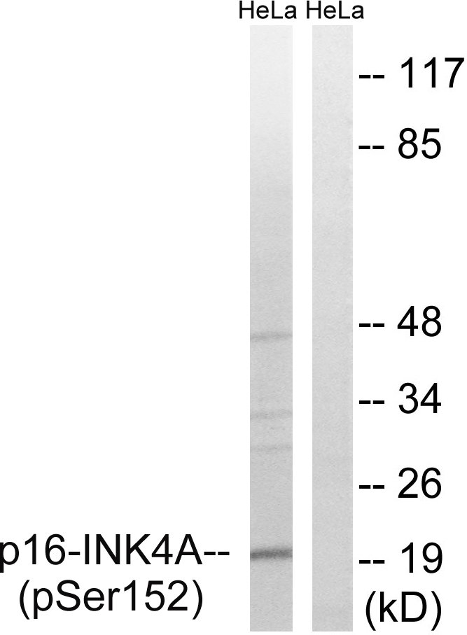 p-CDKN2A (S152) Ab