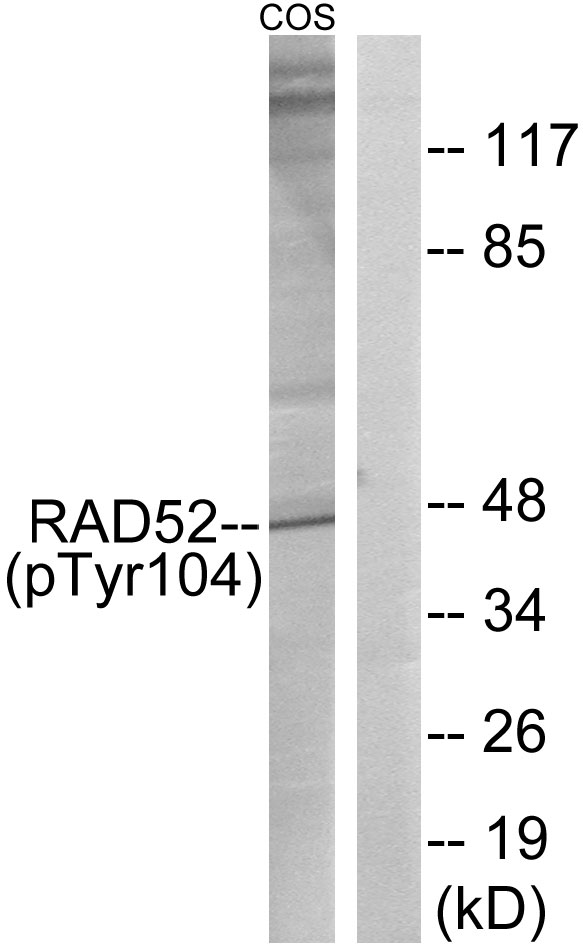 p-RAD52 (Y104) Ab